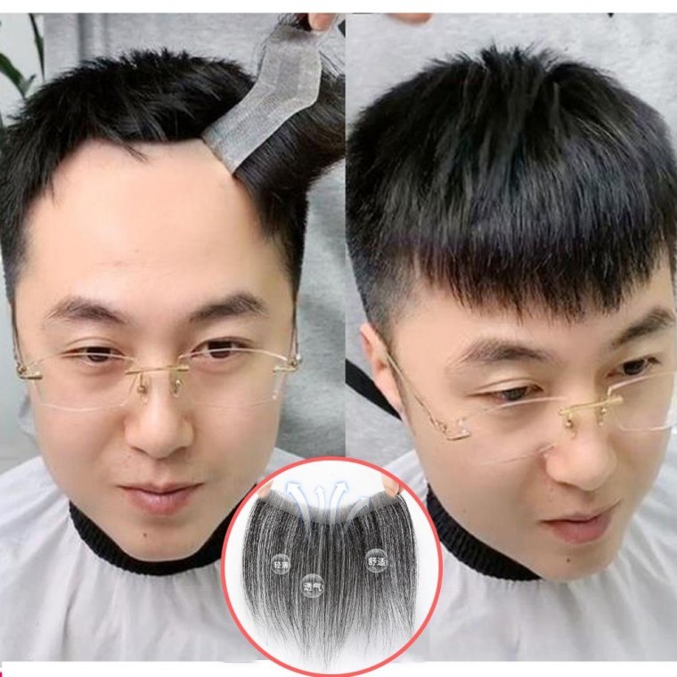인모 남자 엠자 가발 M자 이마 부분 커버 앞머리 붙임 탈모 1 2x16