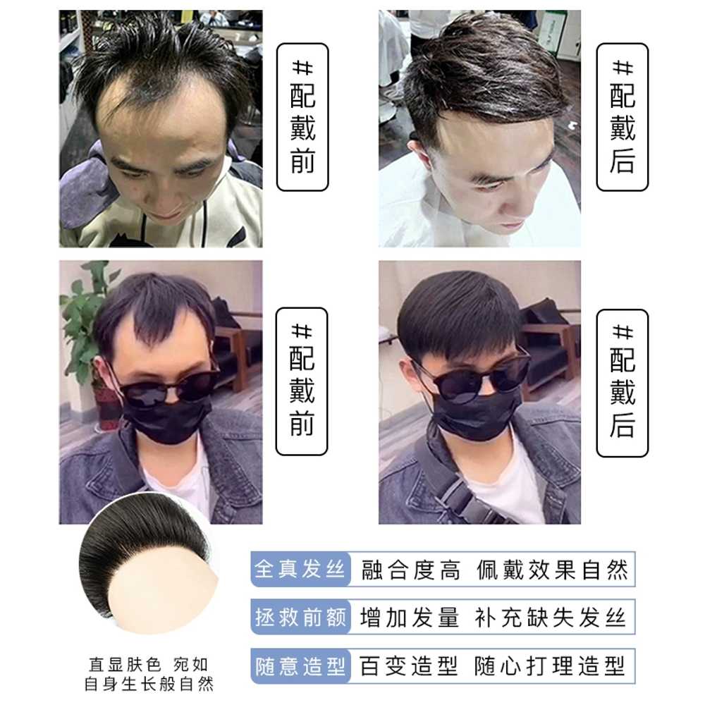 남자 M자 탈부착 피스 헤어라인 커버 붙이는 남성용 가발 앞머리 이마 정수리 머리길이