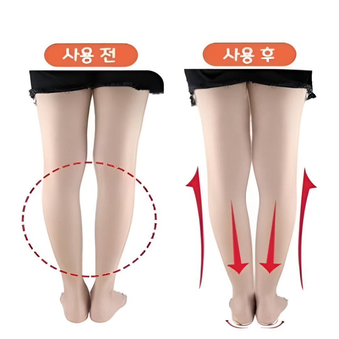 팔자걸음 오다리 휜다리 교정 발건강 운동 다리 깔창 인솔 상품선택 1개 JL L